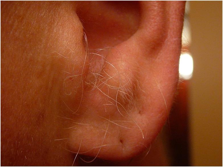 Волосы в ушах