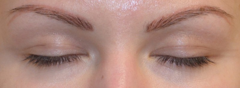 Подготовка к коррекции