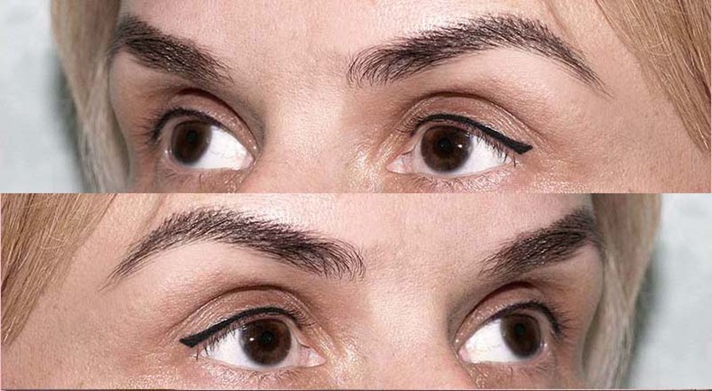 Результат татуажа