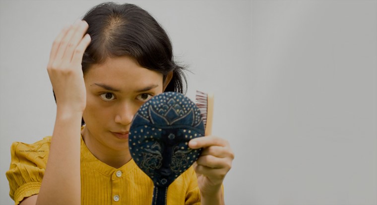 Облысение у женщины