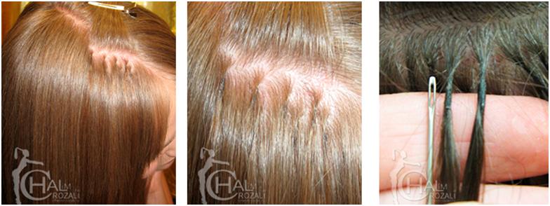 Микронаращивание