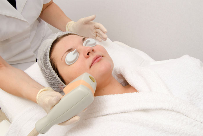 Фотоэпиляция лица