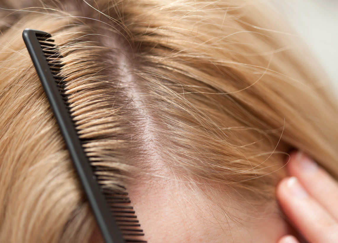 Здоровые волосы