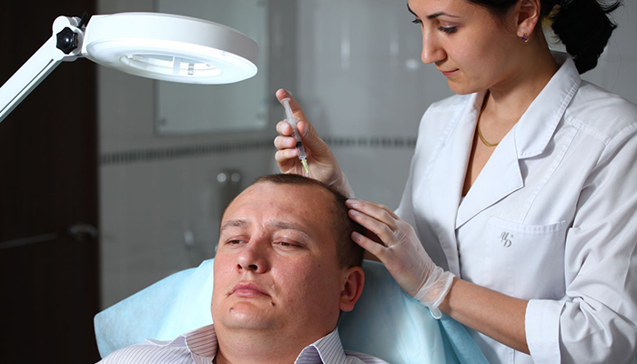 Лечение облысения