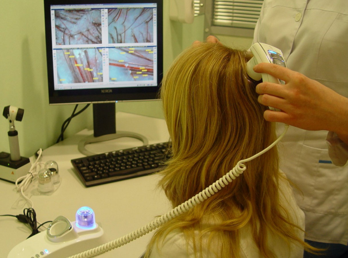 Диагностика волос