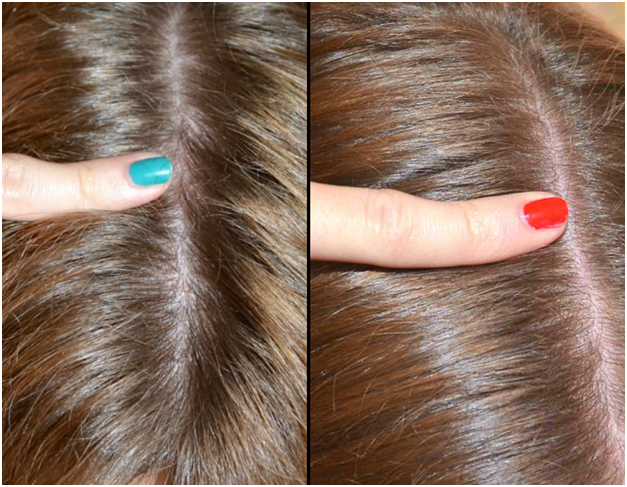 Восстановление волос