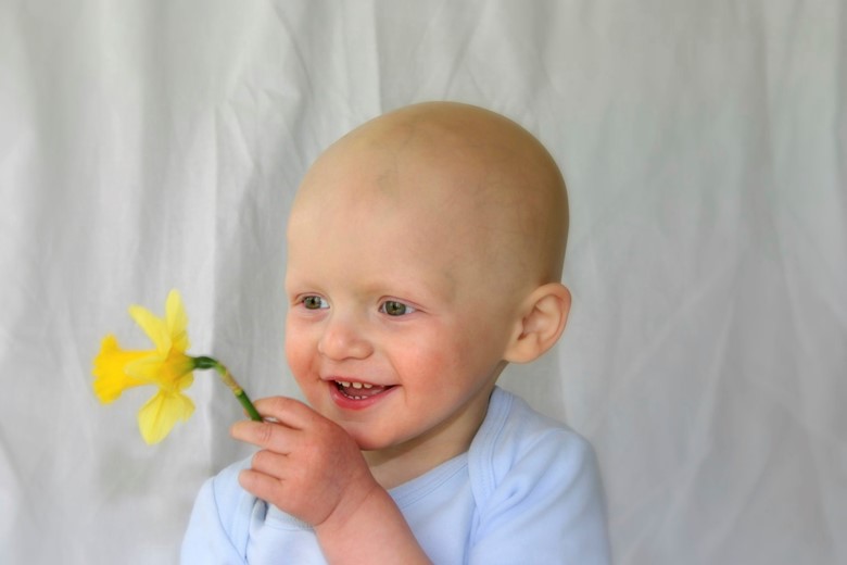 Облысение Облысение