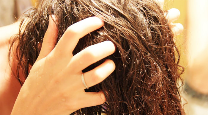 Пилинг кожи головы