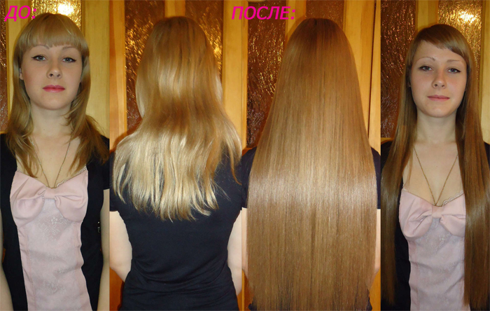 До и после процедуры наращивания