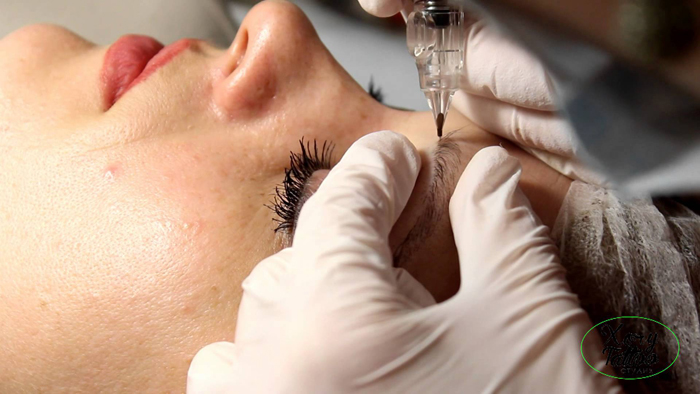 Процедура растушевки