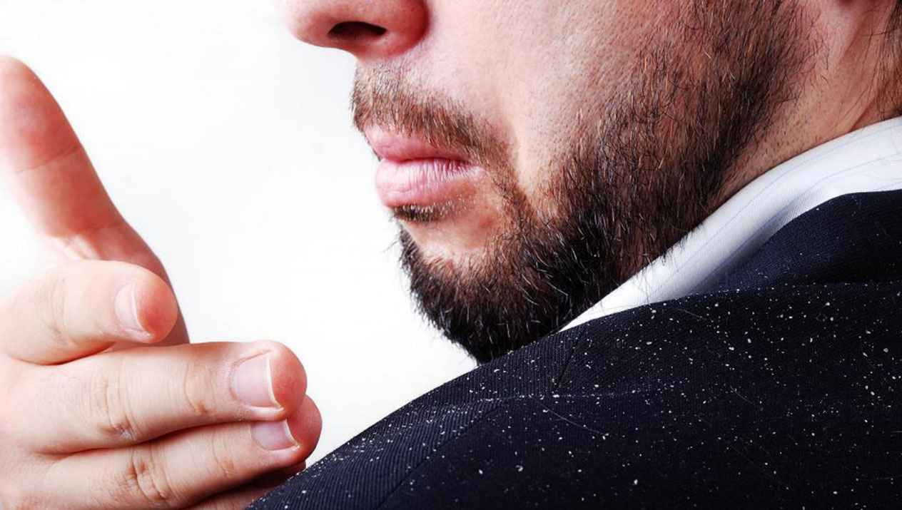 Перхоть у мужчины