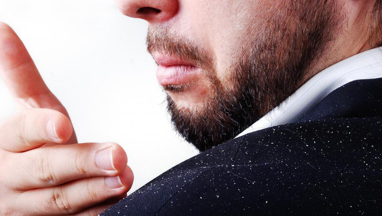 Перхоть у мужчины