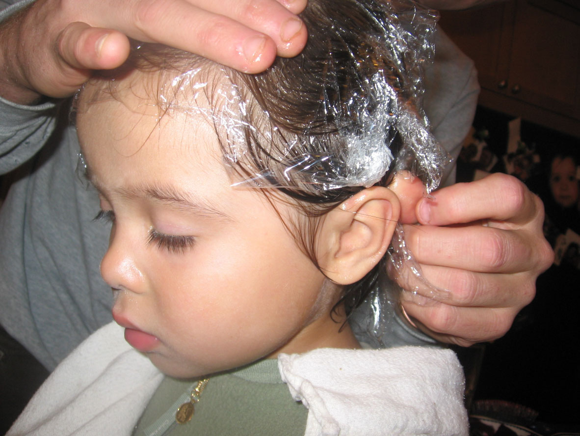 Волосы на лбу ребенка. Стрептодермия у детей YF ujjkdt. Стрептодермия на голове у ребенка. Волосы для детей.