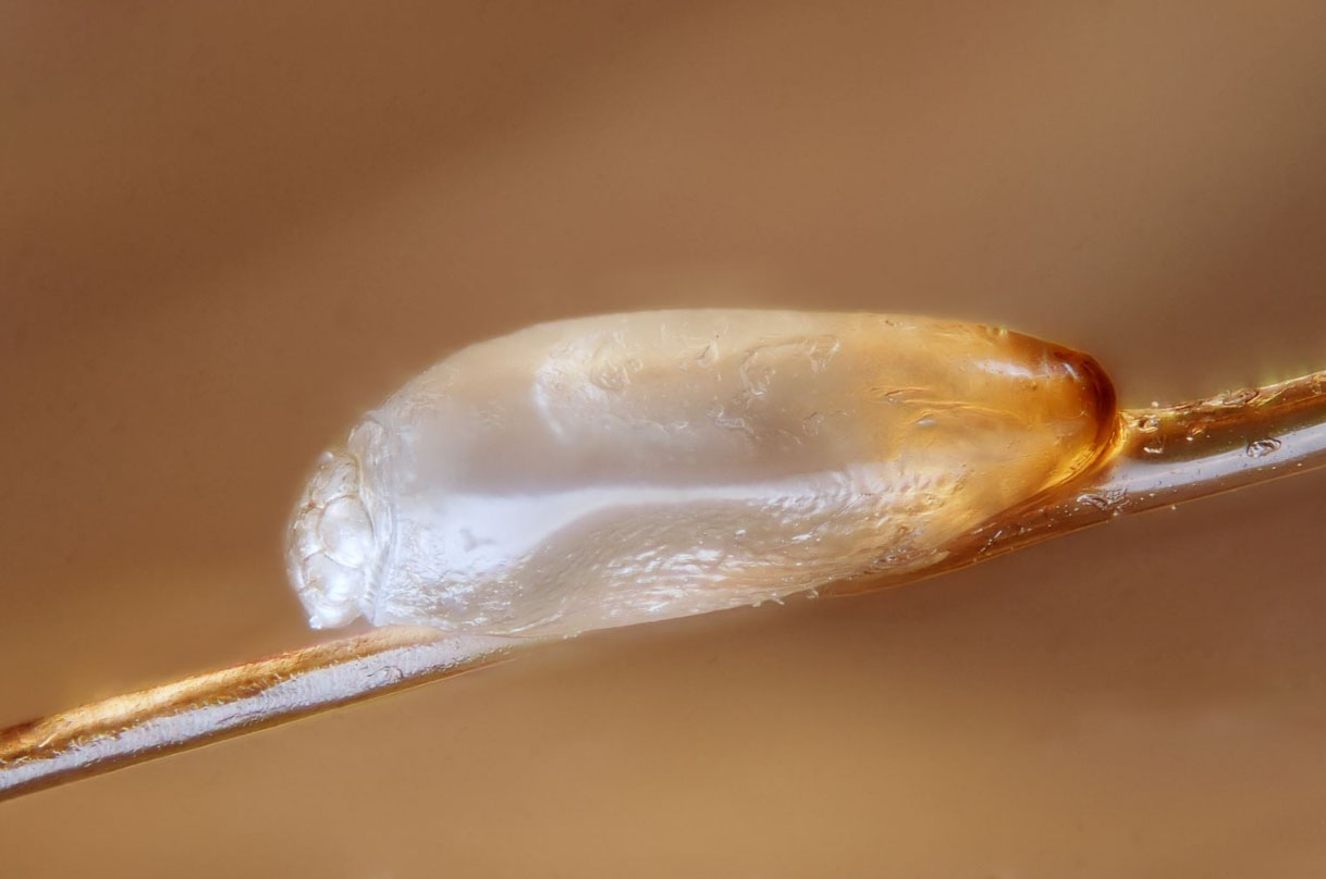 личинка вши на голове