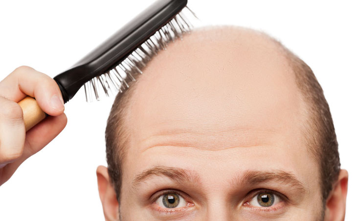 лысый мужчина с расческой